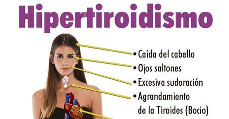 HIPERTIROIDISMO