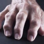 recomendaciones-cuidados-artritis